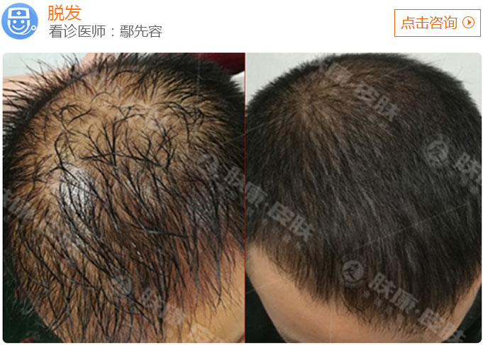 杭州肤康医院